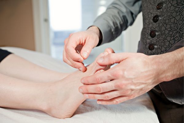 足底筋膜炎に鍼灸治療