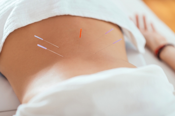 東洋医学と鍼灸あん摩マッサージ指圧による急性腰痛ケア