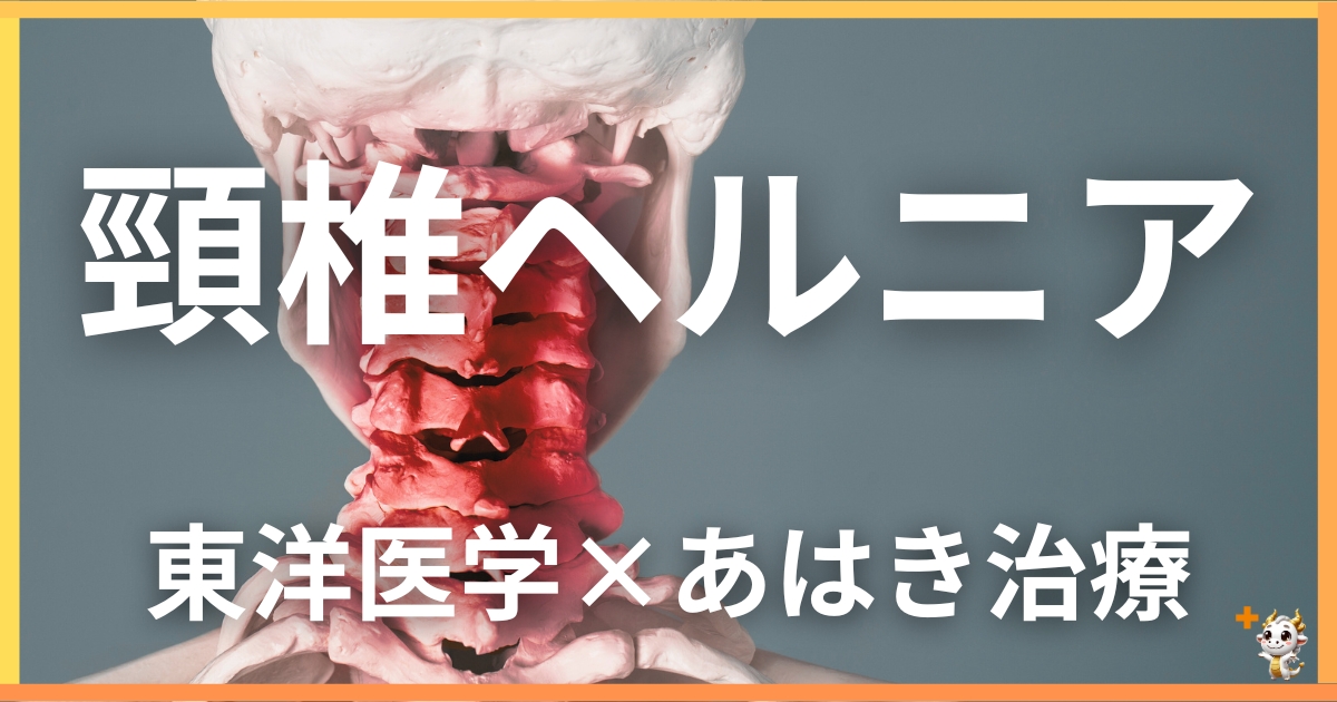 頚椎椎間板ヘルニアを東洋医学の視点から解説｜鍼灸・あん摩マッサージ指圧で自然に改善する方法