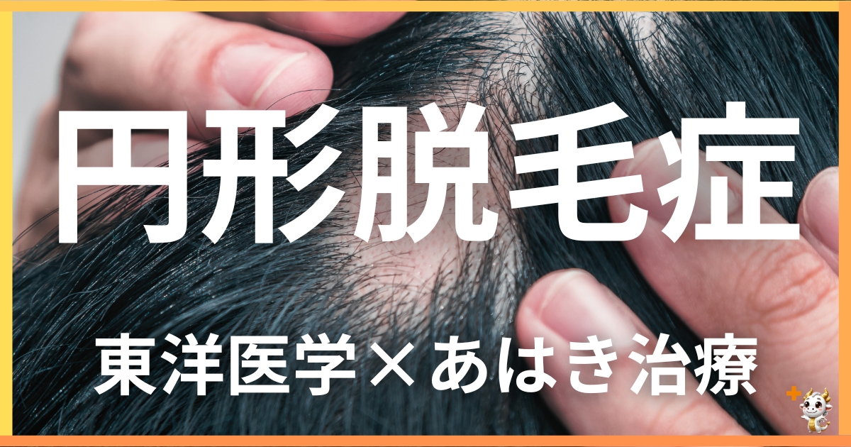 円形脱毛症を東洋医学の視点から解説｜鍼灸・あん摩マッサージ指圧で自然に改善する方法