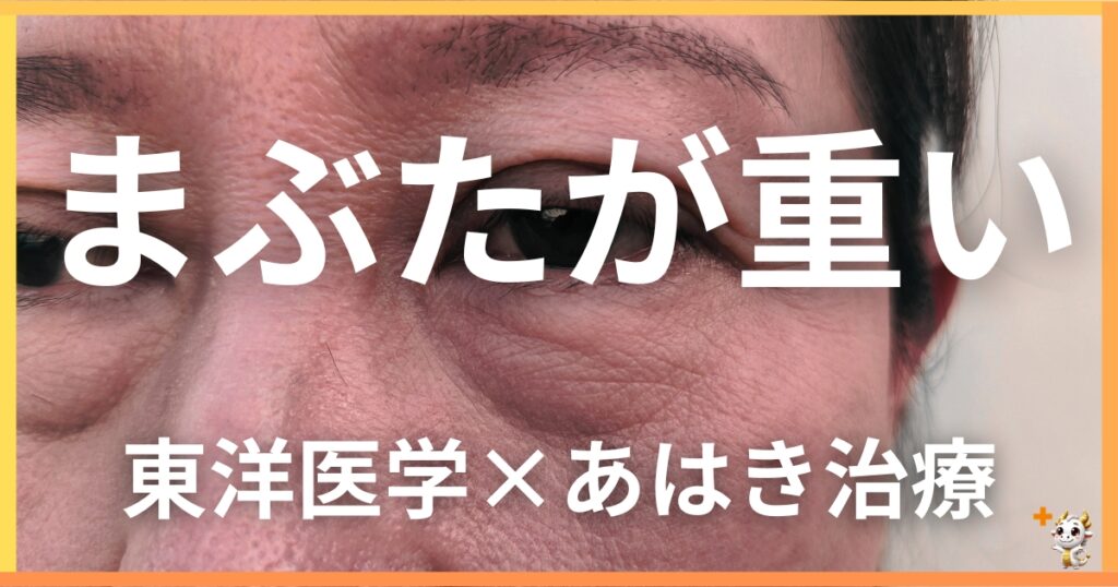 まぶたの重さを東洋医学の視点から解説｜鍼灸・あん摩マッサージ指圧で自然に改善する方法