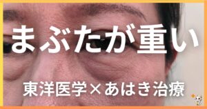 まぶたの重さを東洋医学の視点から解説｜鍼灸・あん摩マッサージ指圧で自然に改善する方法