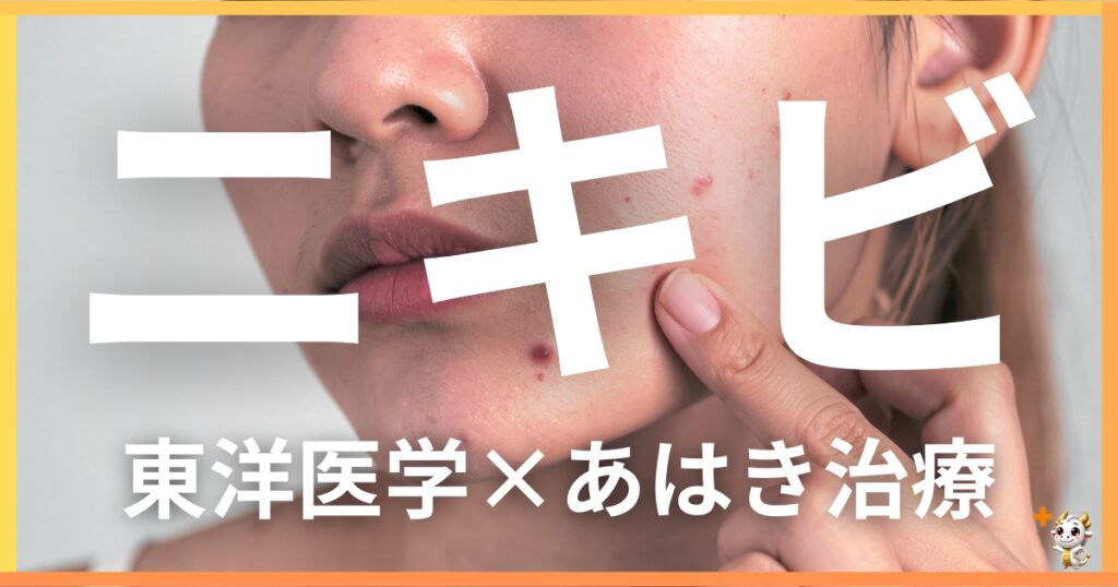 ニキビを東洋医学の視点から解説｜鍼灸・あん摩マッサージ指圧で自然に改善する方法