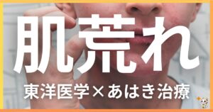 肌荒れを東洋医学の視点から解説|鍼灸・あん摩マッサージ指圧で自然に改善する方法